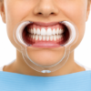 Transparent Type C lip and cheek retractor for improved visibility during dental procedures and photography. Image Description VIDU Type C Lip & Cheek Retractor supplied as a pack of two. Manufactured from transparent, latex-free plastic and suitable for dental photography, whitening procedures and general clinical use. Autoclavable at 121°C.